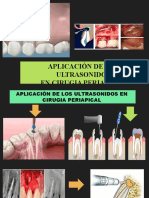Aplicaciòn de Los Ultrasonidos en Cirugìa Periapical