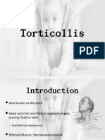 Torticollis