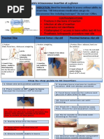 Intraosseous IO Insertion Guide