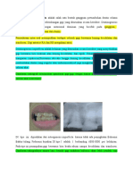 Dentinogenesis Imperfecta