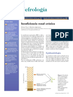 Nefrología: Insuficiencia Renal Crónica