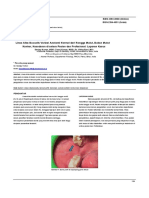 (TRANSLATE) Linea Alba Buccalis A Normal Anatomic Variation of Oral Cavity, Not An Oral - En.id