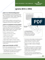 Electrocardiogram (EKG or ECG) Fact Sheet Spanish