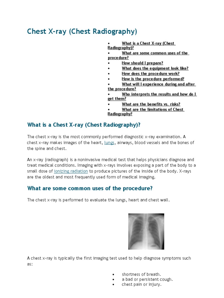 Chest Xray X Ray Radiography