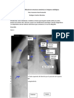 Identificación de estructuras anatómicas en imágenes radiológicas de tórax