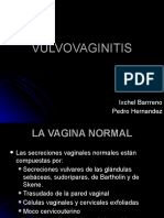 vulvovaginitis-1