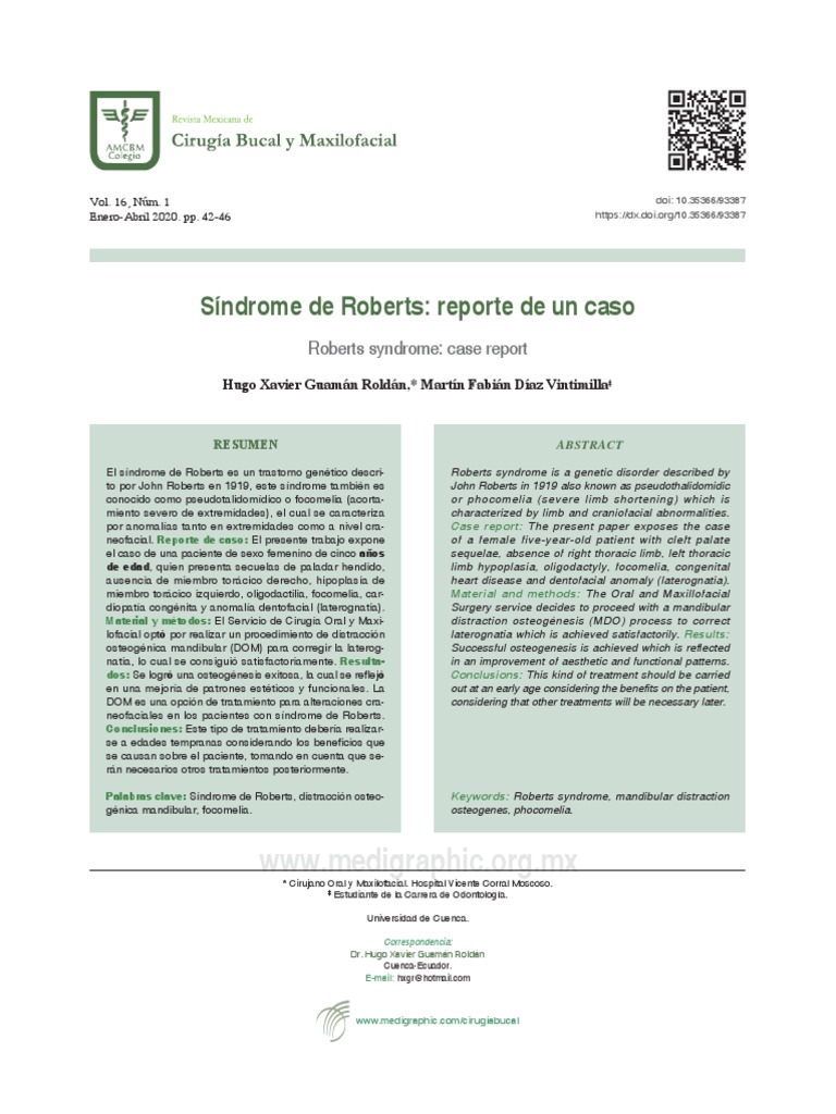 Síndrome de Roberts: Reporte de Un Caso: Roberts Syndrome: Case Report ...