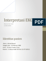 Interpretasi EKG: Meyrina Dwi Yanti 12100119043