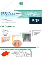 ARDS Prone Position