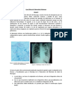 Caso Clínico de Tuberculosis Pulmonar Grupo B