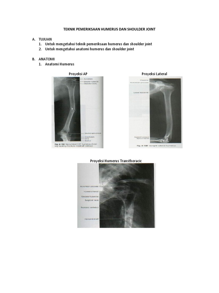 Teknik Pemeriksaan Humerus dan Shoulder | PDF