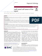 Desmoplastic Small Round Cell Tumor of The Kidney: A Case Report