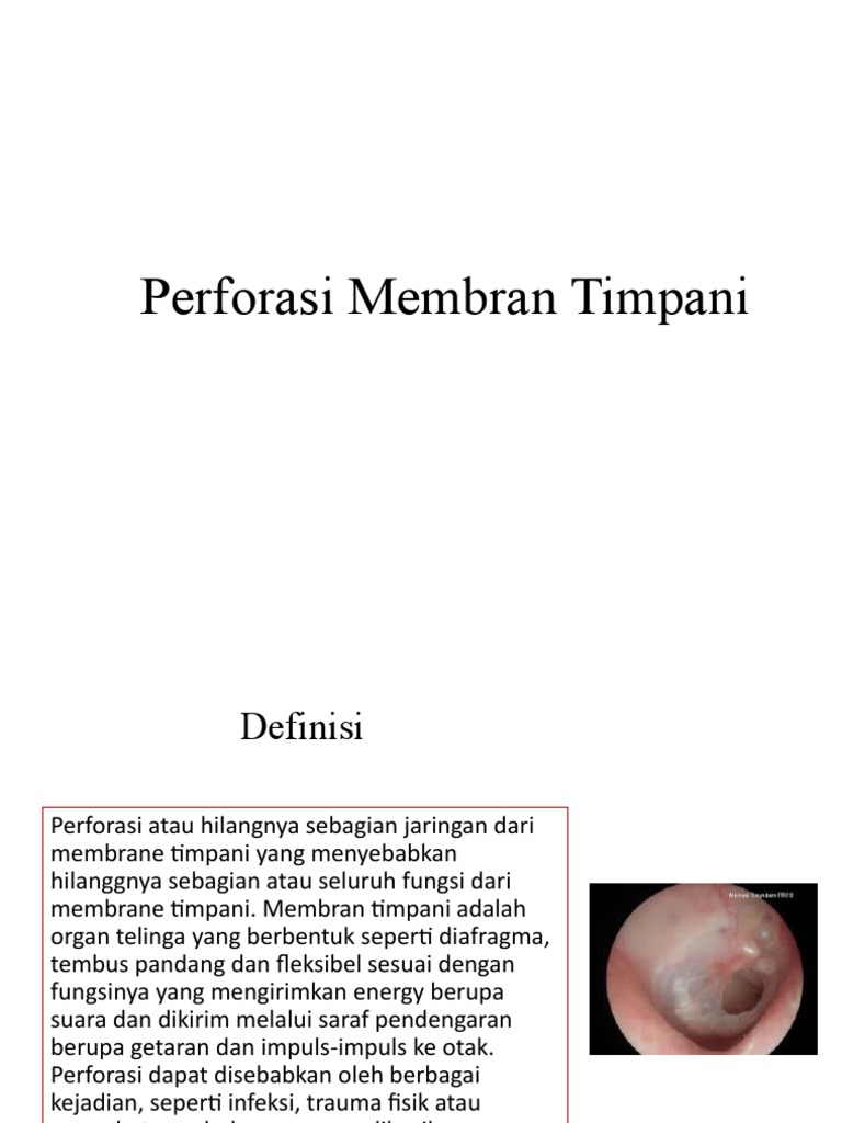 Perforasi Membran Timpani PDF