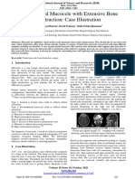 2021 Publication Case Report - Frontal Mucocele