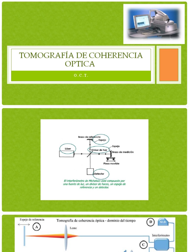 Tomografía de Coherencia Óptica: OCT | PDF | Óptica | Radiación ...