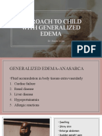 Approach To Child With Generalized Edema: Dr. Sundal Aijaz