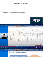 Resumo CURSO DE ECG