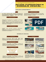 Infografía-Punción Suprapúbica y Sondaje Vesical