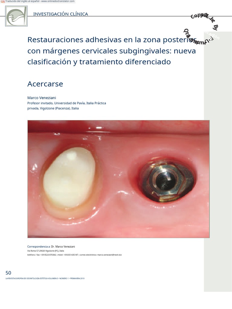 Artículo Prosto Traducido 2 PDF Compuesto Dental Esmalte de dientes