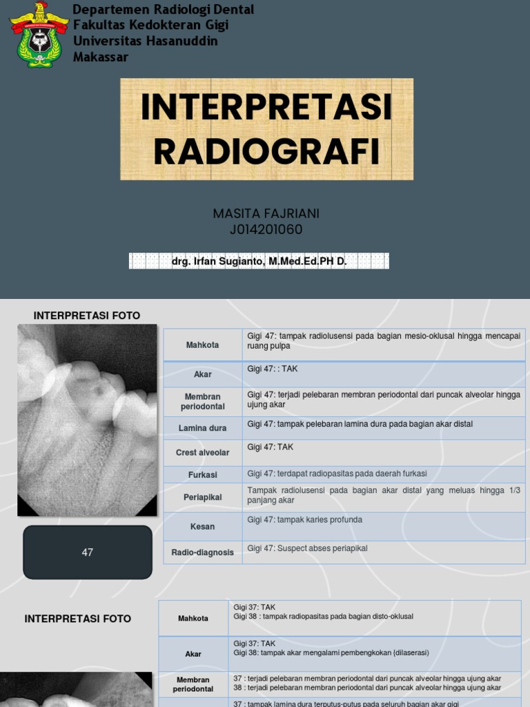 Interpretasi Radiografi Gigi 47 dan 38 | PDF