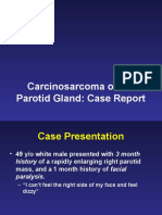 Carcinosarcoma of The Parotid Gland: Case Report