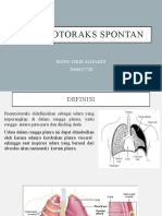 Pneumothorax Spontan