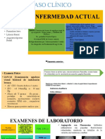 Caso Clinico Uveitis