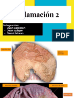 Inflamación 2 (Patología)