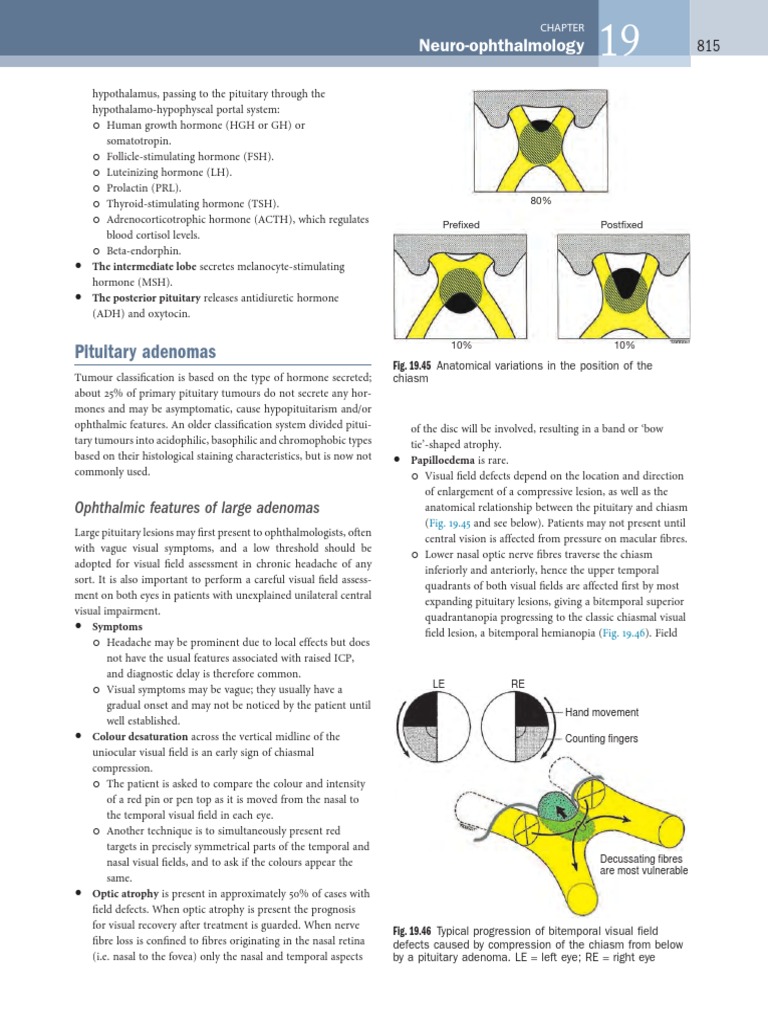 Visual Field Defects of Pituitary Adenomas | PDF | Clinical Medicine ...