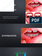 Expoestomatitismicosis (Pozo)