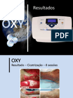 Resultados OXY O3 terapia cicatrização flacidez