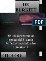 Linfoma de Burkitt