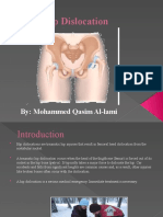 Dislocation of Hip - by - Mohammed Al-Lami