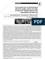 Application of Autologous Platelet Rich Plasma (P.R.P.) in The Extraction of Third Impacted Mandibular Molar