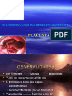 Placenta Unsaac