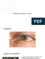 ppt patologías oculares