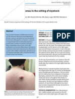 Multiple Pilomatricomas in The Setting of Myotonic Dystrophy