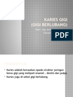 Karies Gigi