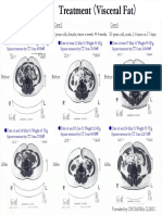 (Clinical Paper) Visceral_fat