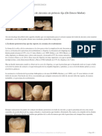 Decálogo de Uso Del Óxido de Zirconio en Prótesis Fija (DR - Ernest Mallat)