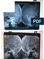 ENT X ray