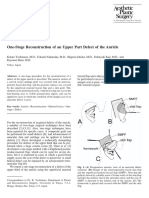 One-Stage Reconstruction of An Upper Part Defect of The Auricle