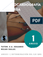 Anexo Modulo Iv, #1, Determinacion Eje QRS