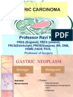 Gastric Carcinoma: Professor Ravi Kant