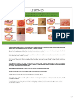 Lesiones Primarias de La Piel