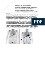 Amiloidosis Senil