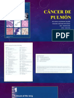 Cáncer de Pulmón: Md. Mayra Valderrama Saldaña Rotación: Anatomía Patológica Mr3 - Neumología Upch - H.N.E.R.M