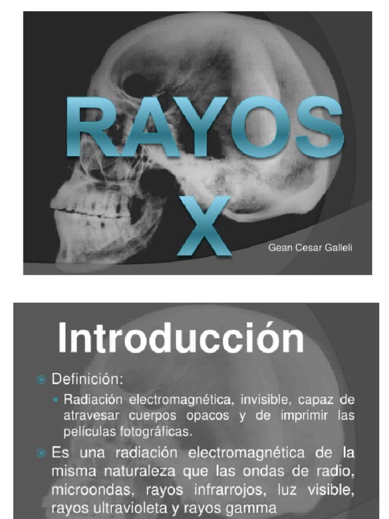 Rayos X | PDF