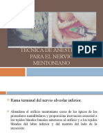 TÉCNICA DE ANESTESIA PARA EL NERVIO MENTONIANO