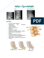 4. Espondilólise e Espondilolistese